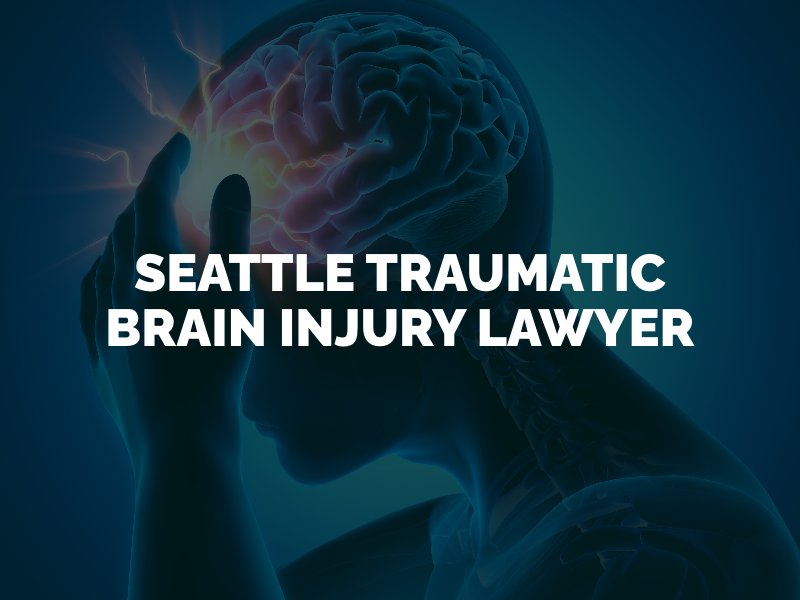 Seattle Traumatic Brain Injury Lawyer